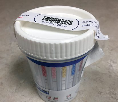 A cup of urine with a lid and some labels