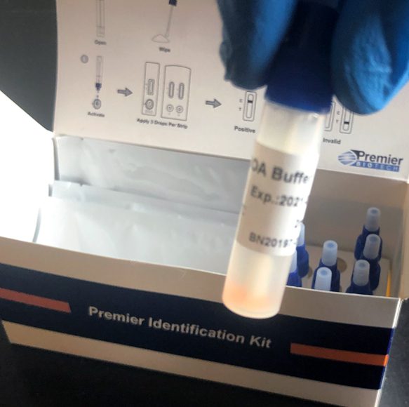 A person holding a tube of blood in front of a box.